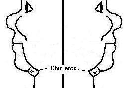 chin arcs